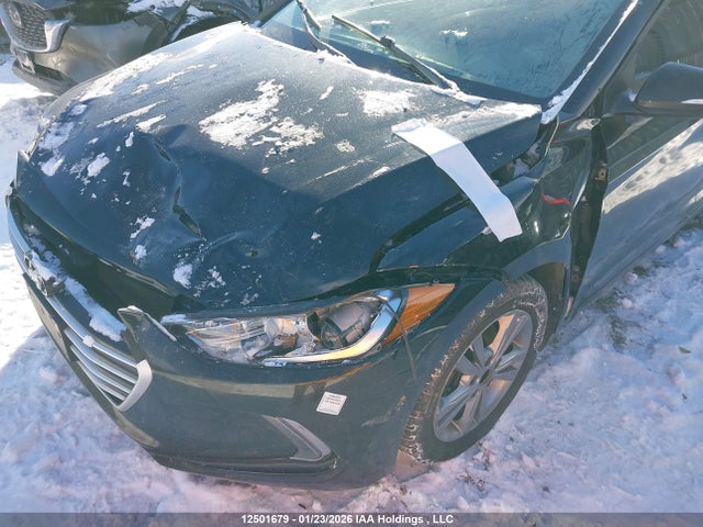 KMHD84LF2JU528193 Hyundai Elantra Gl Se