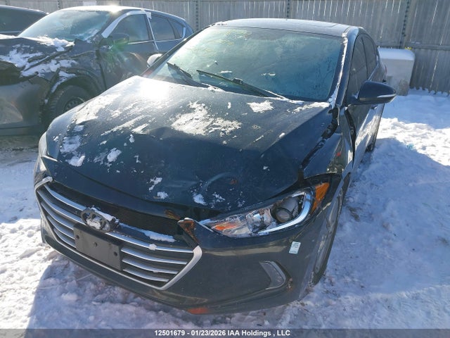 KMHD84LF2JU528193 Hyundai Elantra Gl Se