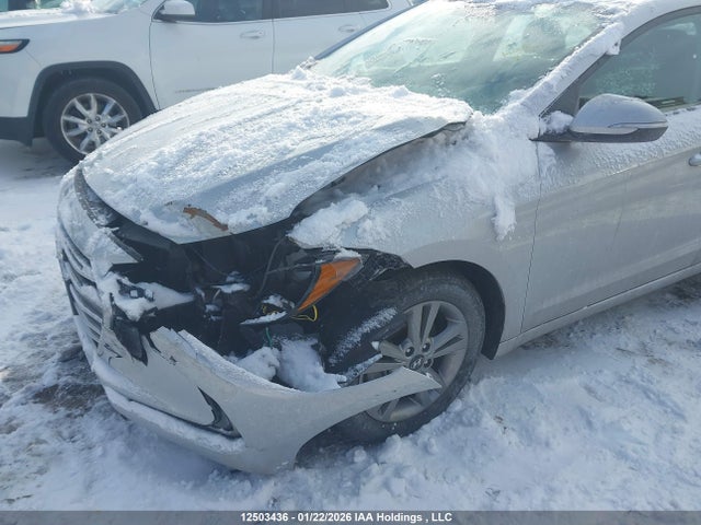 KMHD84LF9JU584535 Hyundai Elantra