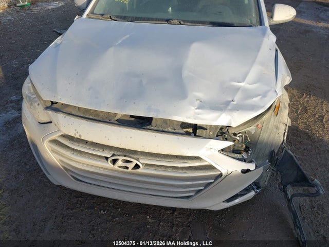 KMHD84LF4HU100801 Hyundai Elantra