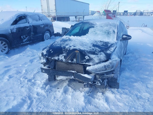 KMHD84LF2HU155232 Hyundai ELANTRA GL