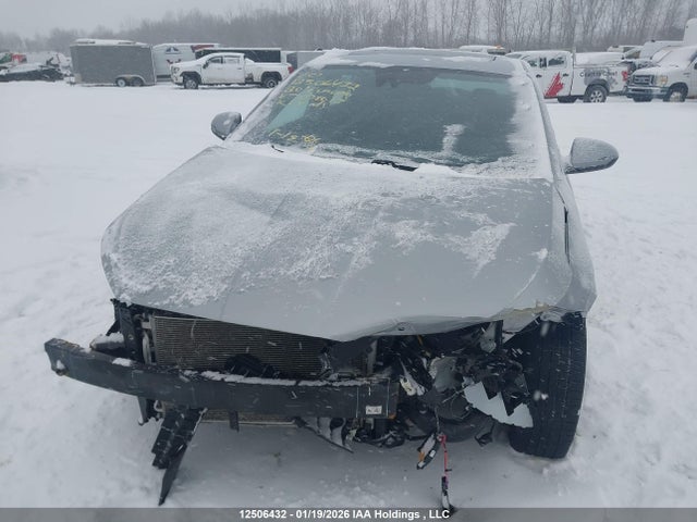 KMHD84LF9LU078013 Hyundai Elantra