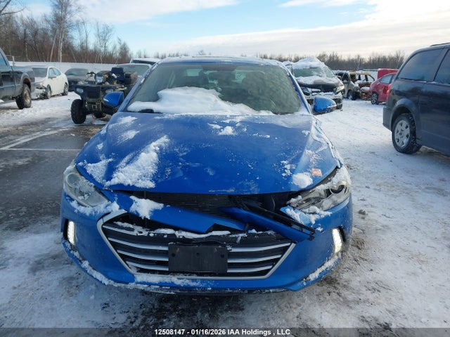 KMHD84LF3HU266033 Hyundai Elantra Gls