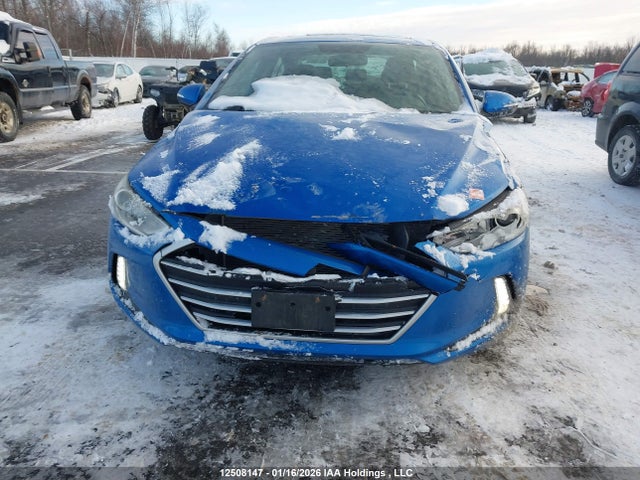 KMHD84LF3HU266033 Hyundai Elantra Gls
