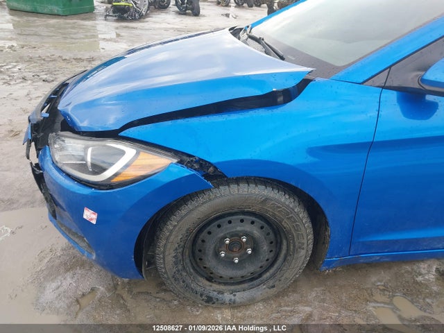 KMHD84LF0HU087822 Hyundai Elantra Se/value/limited