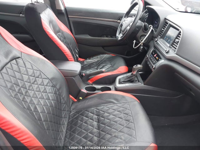 KMHD84LF9HU239998 Hyundai ELANTRA GL
