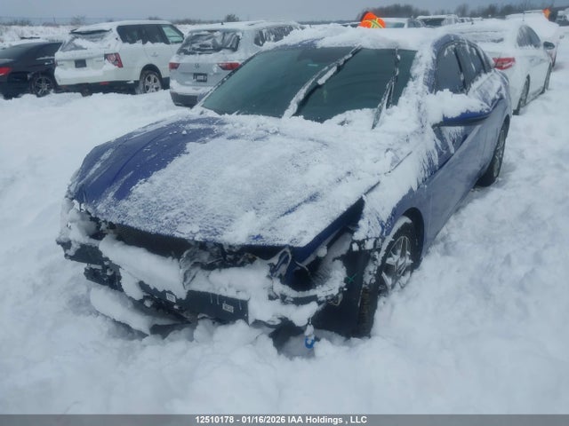 KMHLN4AJ0NU026414 Hyundai Elantra Hybrid Ultimate