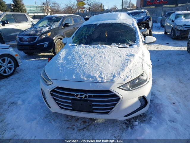 KMHD84LF9JU676034 Hyundai Elantra