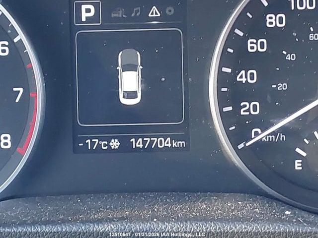 KMHD84LF9JU676034 Hyundai Elantra