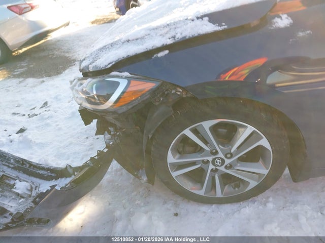 KMHD84LF1JU684290 Hyundai Elantra Limited