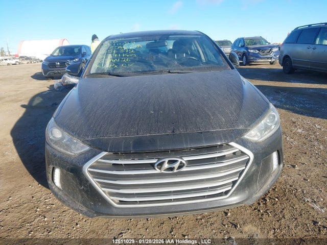 KMHD84LF1JU696312 Hyundai Elantra Sel/value/limited