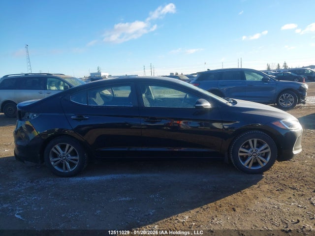 KMHD84LF1JU696312 Hyundai Elantra Sel/value/limited