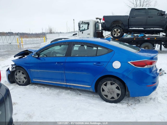 KMHD84LF5JU525076 Hyundai Elantra