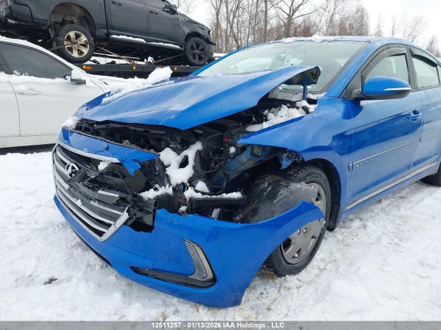 KMHD84LF5JU525076 Hyundai Elantra