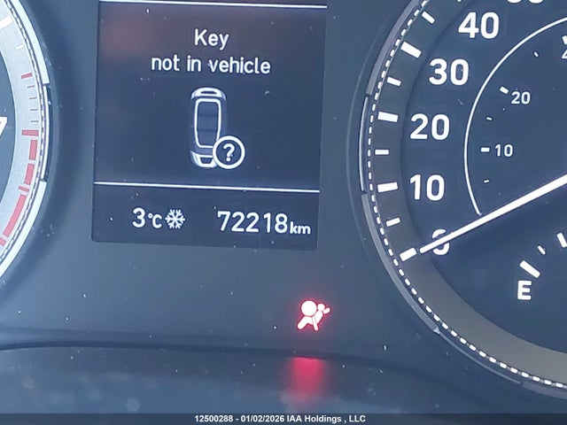 Hyundai Venue Ultimate With Black Interior 2022 KMHRC8A35NU186376 Image 15