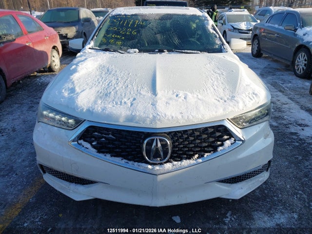 19UUB1F31JA800886 Acura TLX