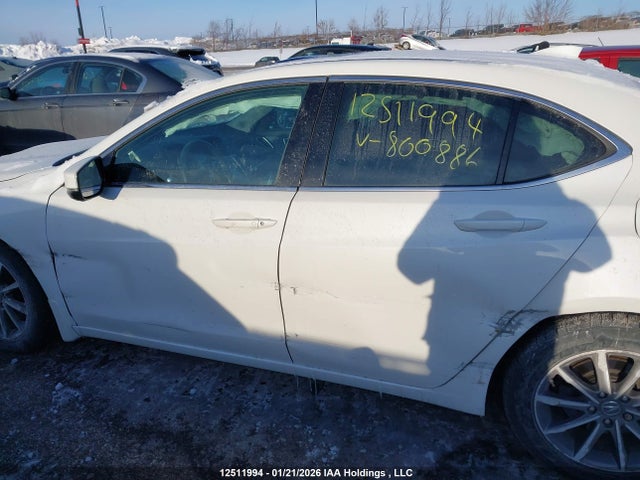 19UUB1F31JA800886 Acura TLX