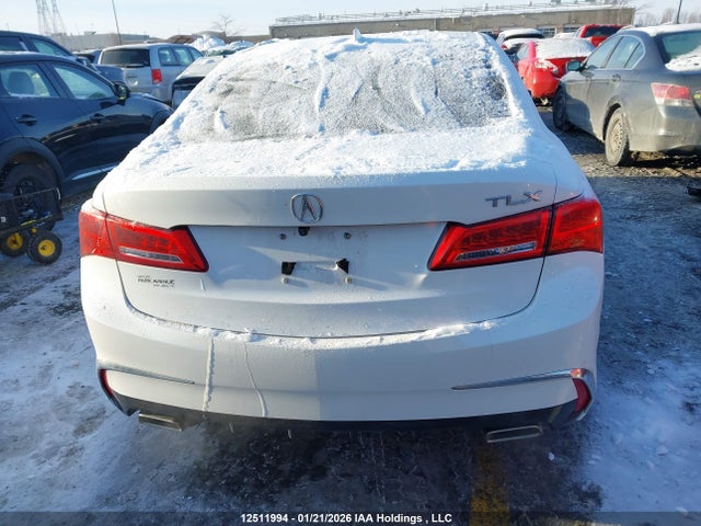 19UUB1F31JA800886 Acura TLX