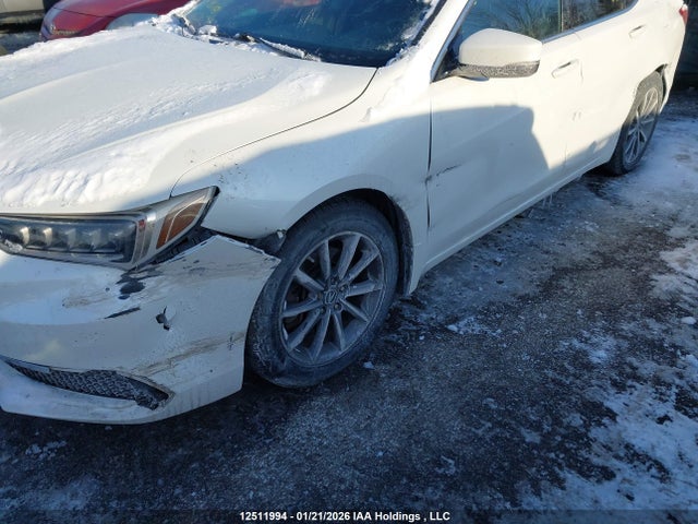 19UUB1F31JA800886 Acura TLX