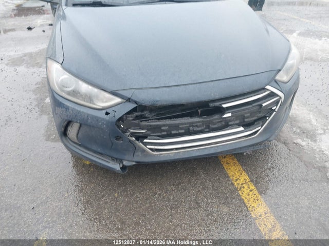 KMHD84LF0HU100567 Hyundai ELANTRA GL