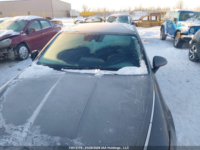 KMHL24JA4PA262285 Hyundai SONATA SE
