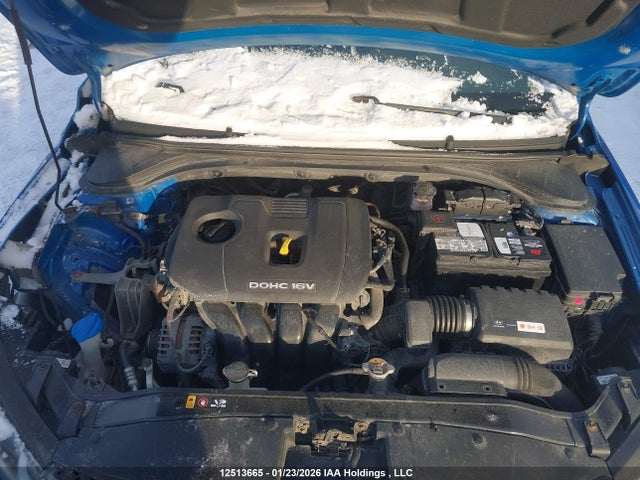 KMHD84LF8HU426987 Hyundai Elantra Gls