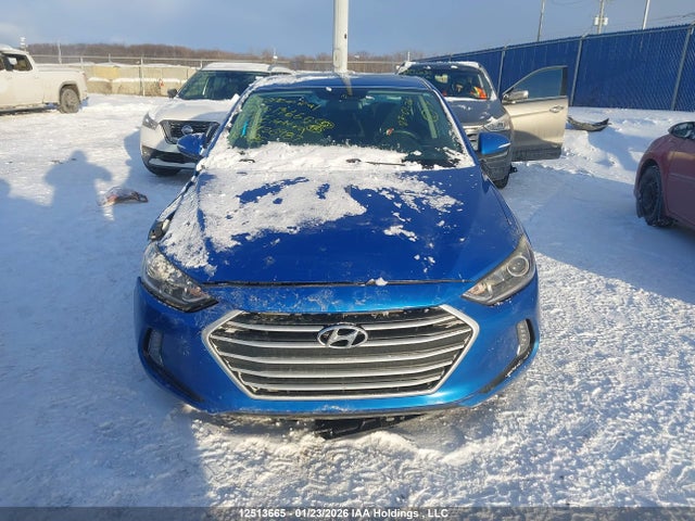 KMHD84LF8HU426987 Hyundai Elantra Gls