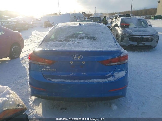 KMHD84LF8HU426987 Hyundai Elantra Gls
