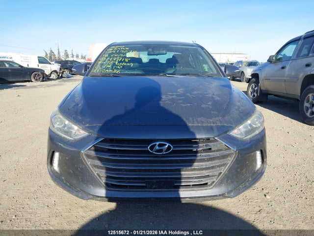 12515672 :رقم المزاد ، KMHD84LF0JU477180 vin ، 2018 Hyundai Elantra Sel/value/limited مزاد بيع