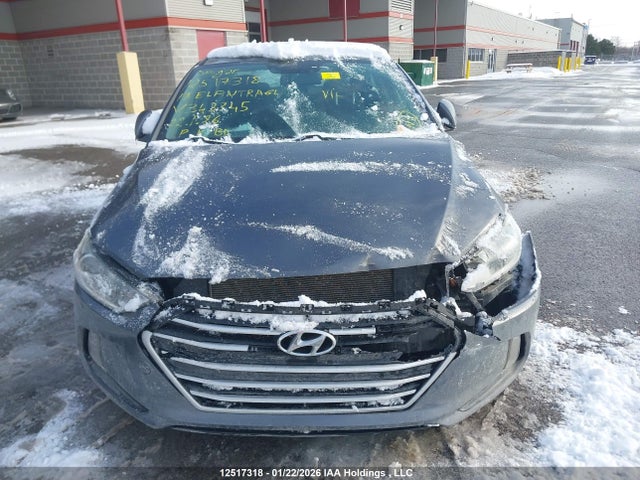 KMHD84LF2HU343345 Hyundai ELANTRA GL