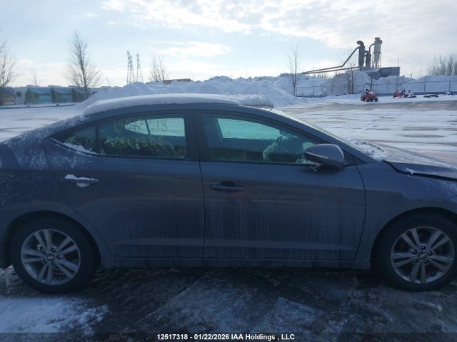 KMHD84LF2HU343345 Hyundai ELANTRA GL