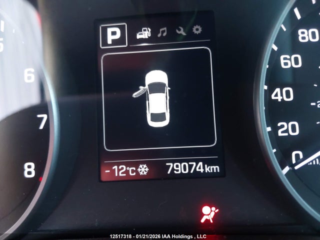 KMHD84LF2HU343345 Hyundai ELANTRA GL