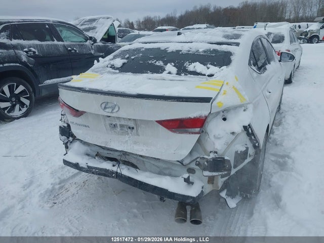 KMHD84LF4JU639103 Hyundai Elantra Gl Se