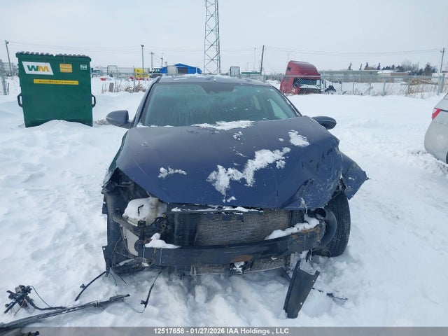 KMHD84LFXKU870119 Hyundai Elantra Ultimate