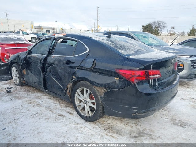 Acura TLX TECH 2015 19UUB1F57FA800108 Image 3