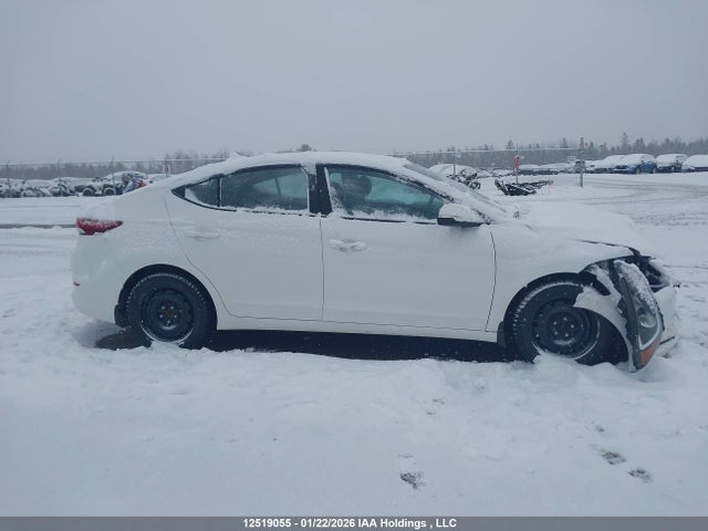 KMHD84LF2JU510115 Hyundai Elantra Sel/value/limited