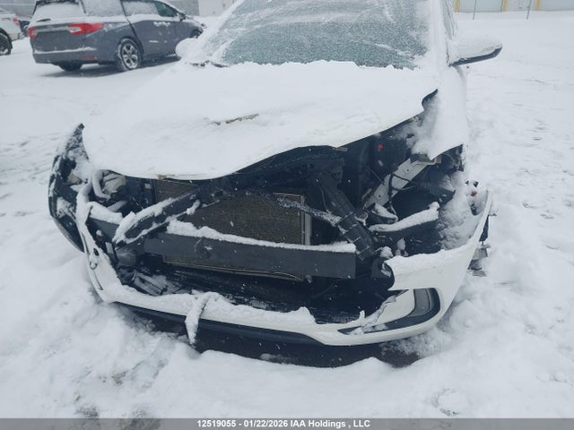 KMHD84LF2JU510115 Hyundai Elantra Sel/value/limited