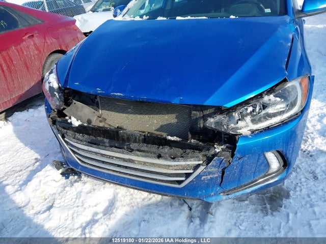 KMHD84LF5JU690285 Hyundai Elantra Sel/value/limited