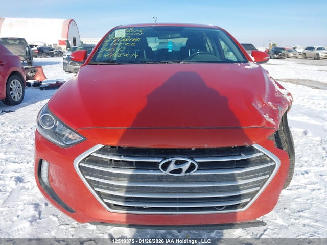 KMHD84LF0HU379504 Hyundai Elantra Se/value/limited
