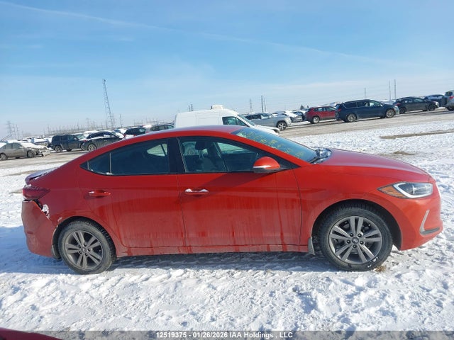 KMHD84LF0HU379504 Hyundai Elantra Se/value/limited