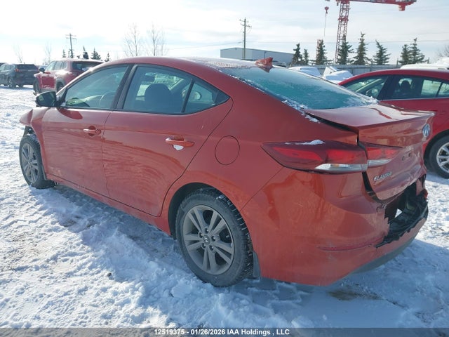KMHD84LF0HU379504 Hyundai Elantra Se/value/limited