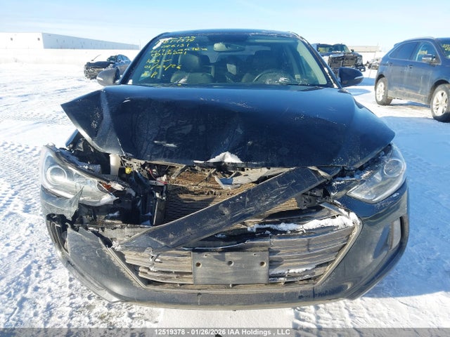 KMHD84LF1HU086131 Hyundai Elantra Se/value/limited
