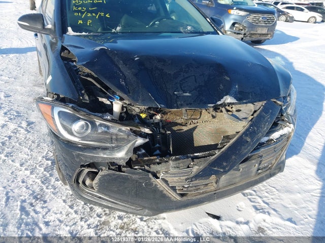 KMHD84LF1HU086131 Hyundai Elantra Se/value/limited