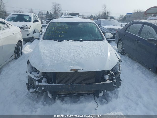 KMHD84LFXHU420060 Hyundai Elantra Se/value/limited
