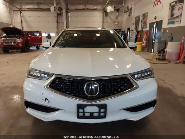 19UUB1F5XKA800713 Acura Tlx Technology