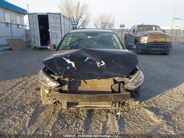 KMHD84LF1HU275409 Hyundai Elantra Se/value/limited