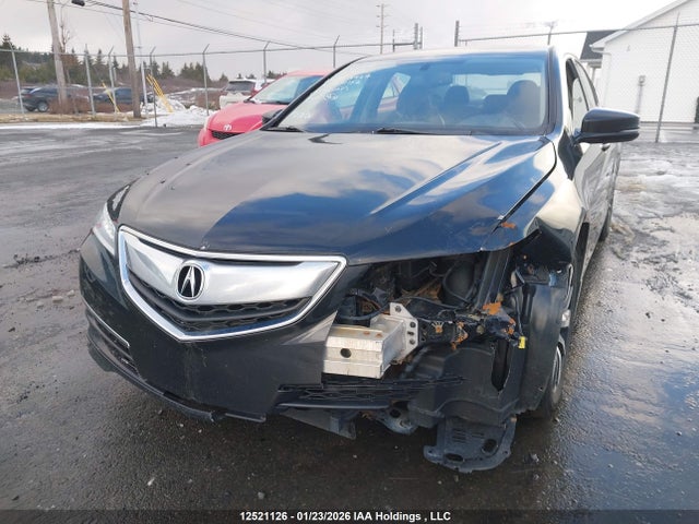 19UUB1F3XGA800152 Acura TLX