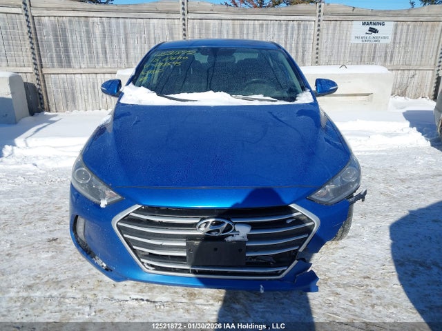 KMHD84LF5JU698595 Hyundai Elantra Sel/value/limited
