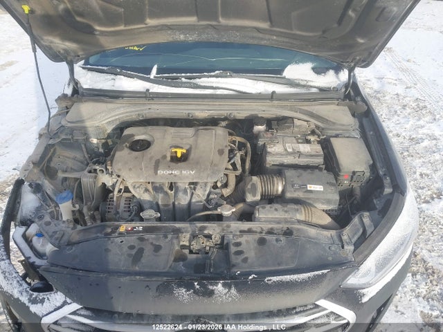 KMHD84LF6JU444751 Hyundai ELANTRA GL