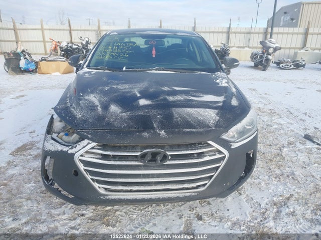 KMHD84LF6JU444751 Hyundai ELANTRA GL
